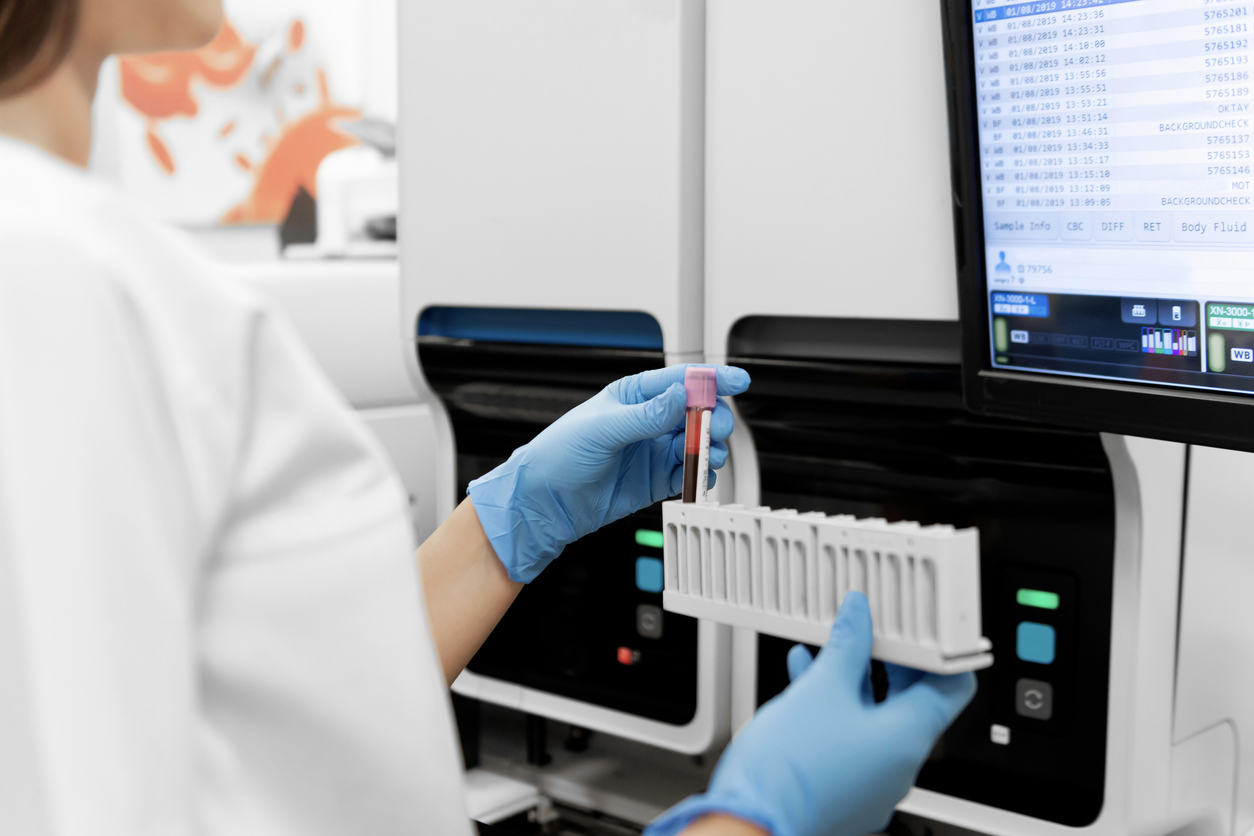 Image showcasing Breakthrough in Dementia Diagnosis: UK Study Explores Revolutionary ...